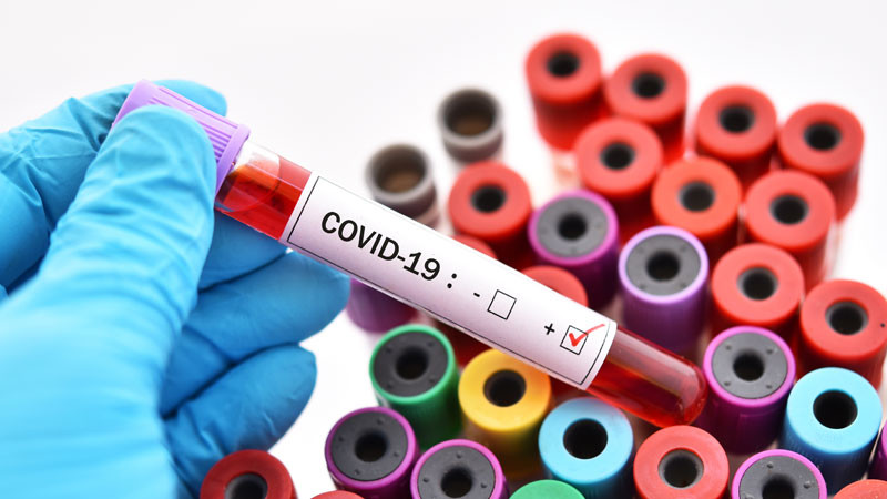 Thumb_coronavirus_new2.jpg Thumb_coronavirus_new2.jpg